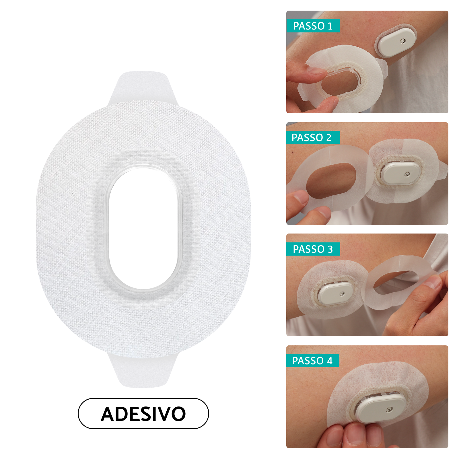 Passo a passo da aplicação do Overpatch